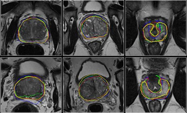 Albert Dedmon – Bellaire, TX