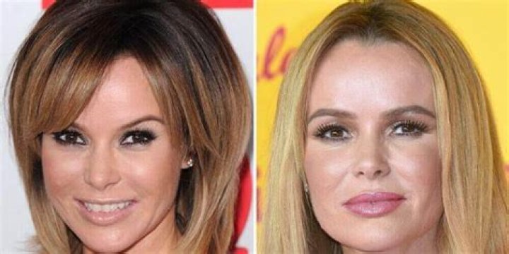 Amanda Holden Plastic Surgery: From Natural to Enhanced 