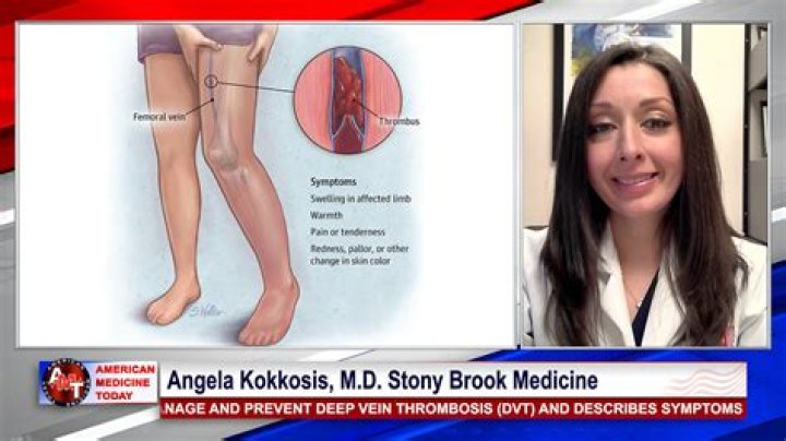 Dr. Angela Kokkosis, MD – Stony Brook, NY