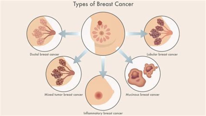 Anne Thompson NBC Age: Does She Have A Breast Cancer?