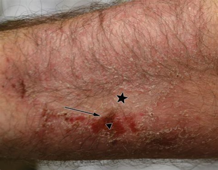 Dr. Argentina Leon, MD – San Ramon, CA