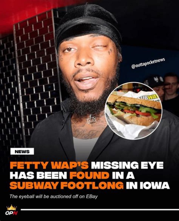 Can Fetty Wap Fix His Eye? – Celebrity