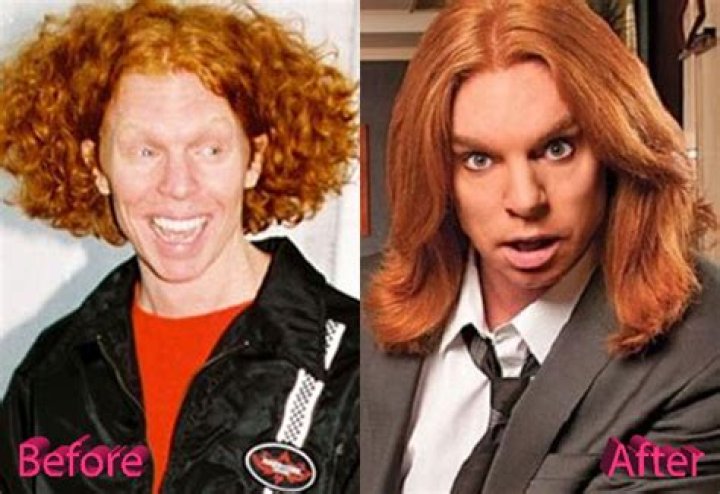 Carrot Top Plastic Surgery: Changing Lifestyle or An Excessive Surgical Transformation!