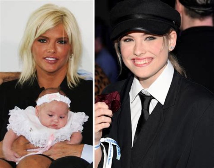 Disability: Anna Nicole Smith’s Daughter Dannielynn Had Strabismus!