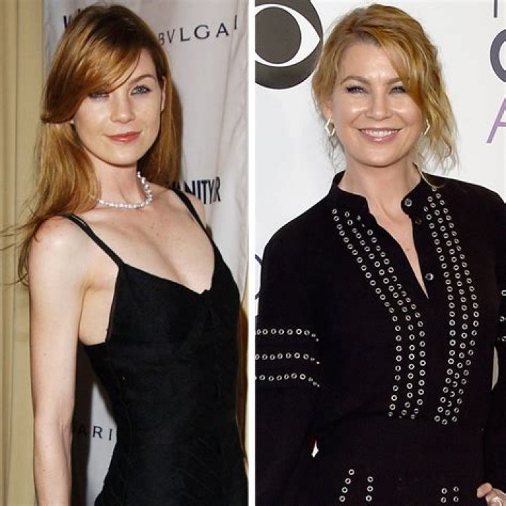 Ellen Pompeo Plastic Surgery Before and After