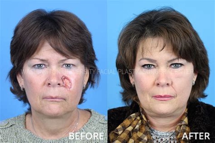 Facial Plastic Surgery jobs | Doximity