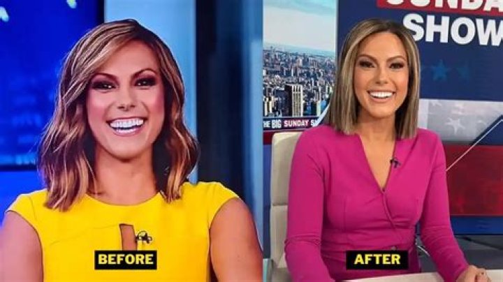 Fox News Lisa Boothe Plastic Surgery – Watch Before and After Pictures