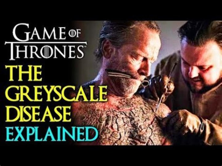 How did Samwell Tarly cure Jorah Mormont’s greyscale disease in ‘Game of Thrones’?