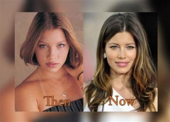 Jessica Biel’s Plastic Surgery: Has The Sinner Star Had a Nose Job and Lip Fillers? Check Out the Before and After Pictures!