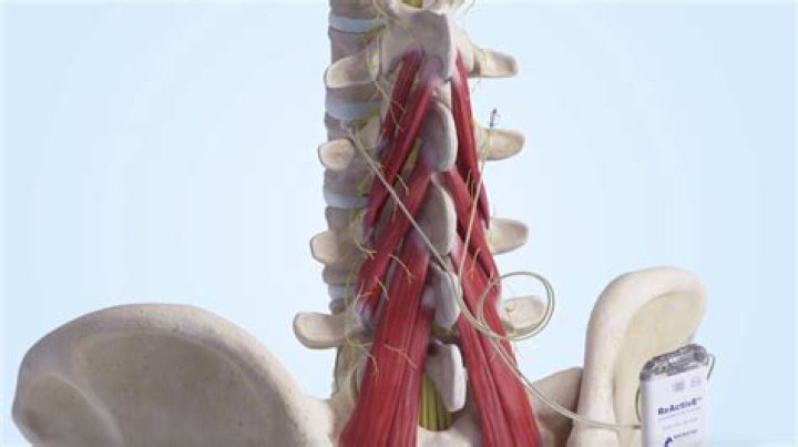 Dr. Jonathan Gentile II, MD – Carmel, IN