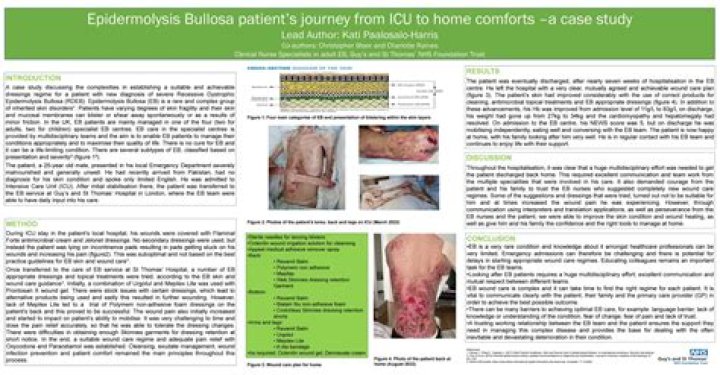 Journalist Myra Ali dies from Rare Condition Epidermolysis Bullosa