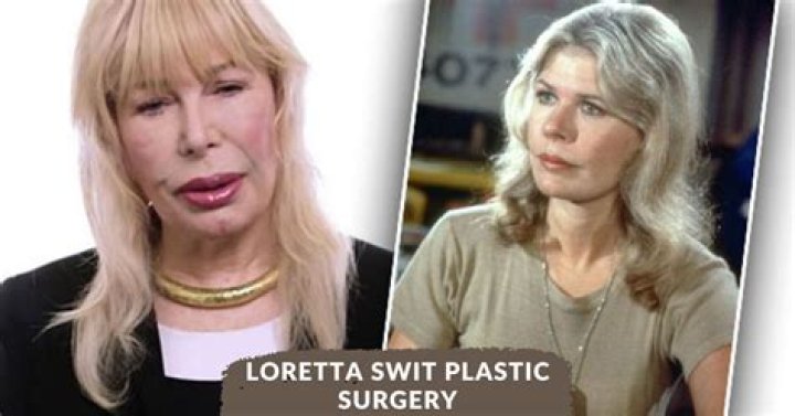 Loretta Swit Plastic Surgery: Loretta's Altered Appearance Went Wrong?