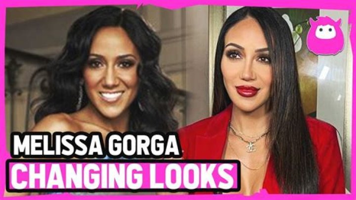 Melissa Gorga’s Plastic Surgery: The Real Housewives Star’s Before and After Pictures Examined; Learn About Her Diet & Workout Routine!