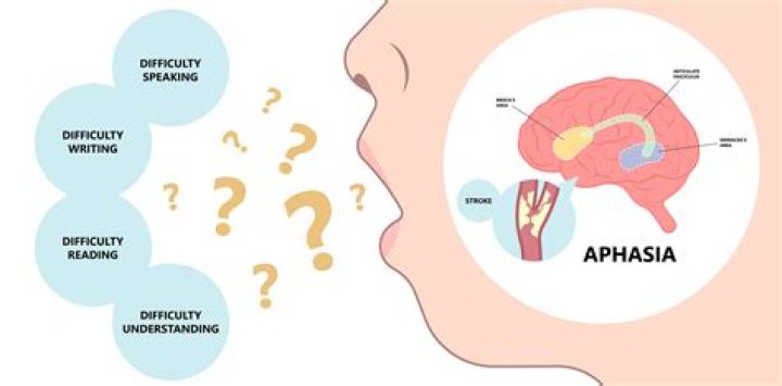 Signs You May Have Aphasia, Like Bruce Willis — Celebwell