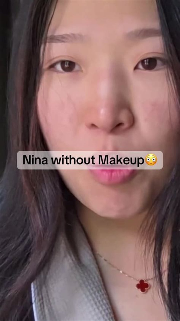 Dr. Nina Lin, MD – Boston, MA