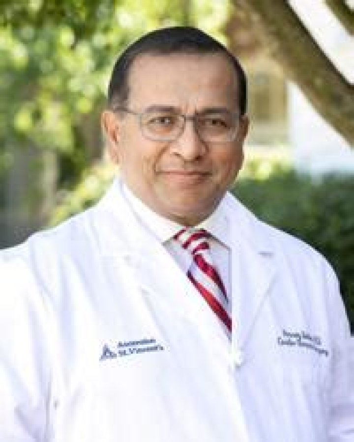 Dr. Parvez Sultan, MD – Birmingham, AL
