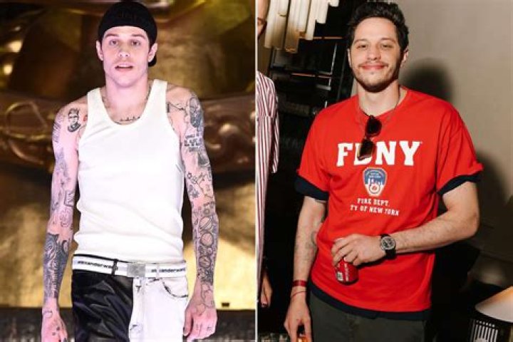 Pete Davidson To Remove All His Tattoos – Here’s Why!
