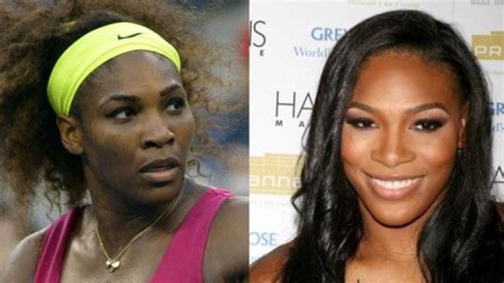Serena Williams’ Plastic Surgery: Rumors of A Nose Job, Breast Implants, and Butt Augmentation!
