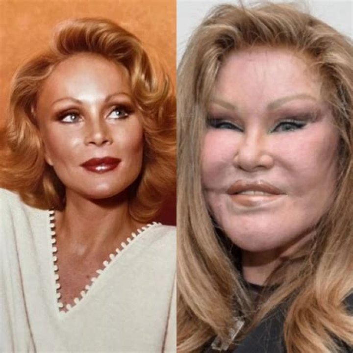 Socialite Jocelyn Wildenstein Before Surgery: Botched Transformation Gone Wrong Photos
