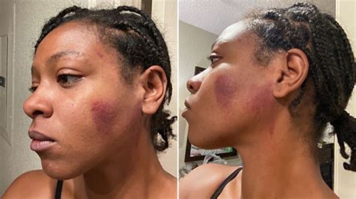 Teenage pro-life activist allegedly punched in the face after knocking on doors in Kansas
