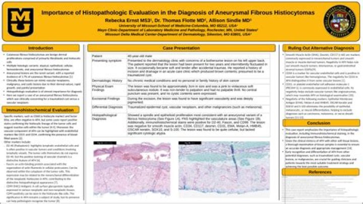 Dr. Thomas Flotte, MD – Rochester, MN