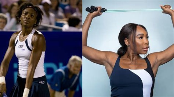 
Venus Williams | Weight Loss | Before And After 