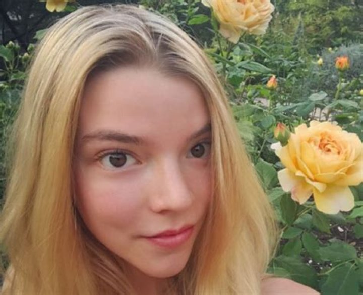 What Is Anya Taylor-Joy’S Natural Hair Colour? – Celebrity