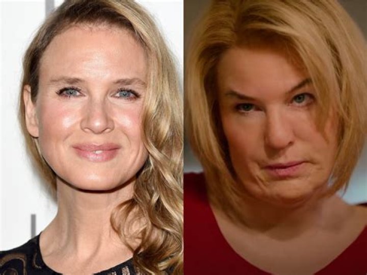 Whatever Happened To Renee Zellweger Following Weight Gain And Plastic Surgery Rumors? Details To Know