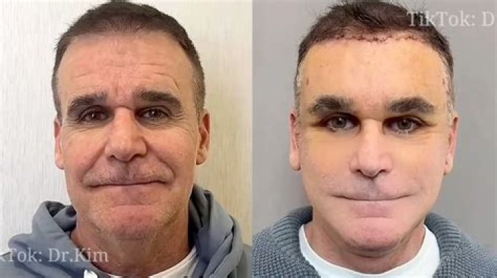 Who is TikTok’s Liver King?