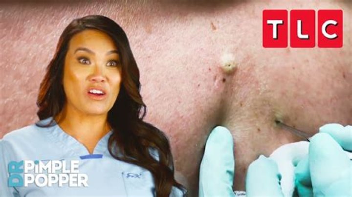Who Was Brittany Sharp On Dr. Pimple Popper? – Celebrity