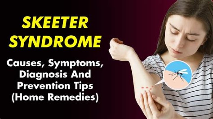 Why is Skeeter called Skeeter in The Help? – Celebrity